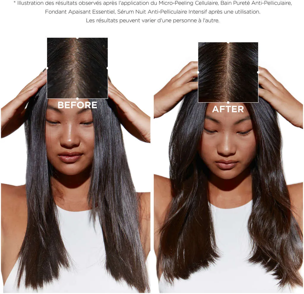 Kérastase Symbiose Bain Pureté Anti-Pelliculaire - 250 ml