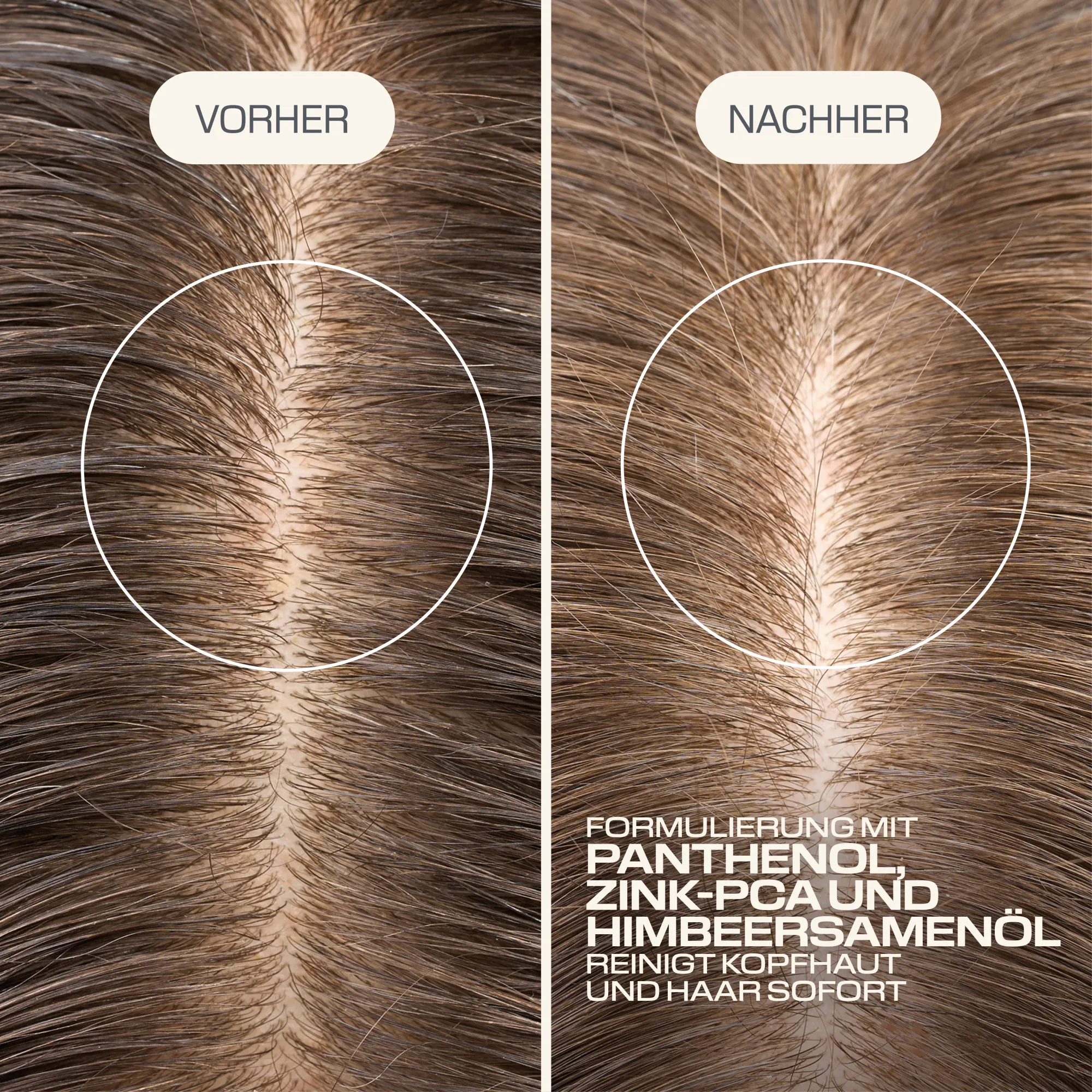 Goldwell DS SCALP SPECIALIST Shampooing purifiant en profondeur
