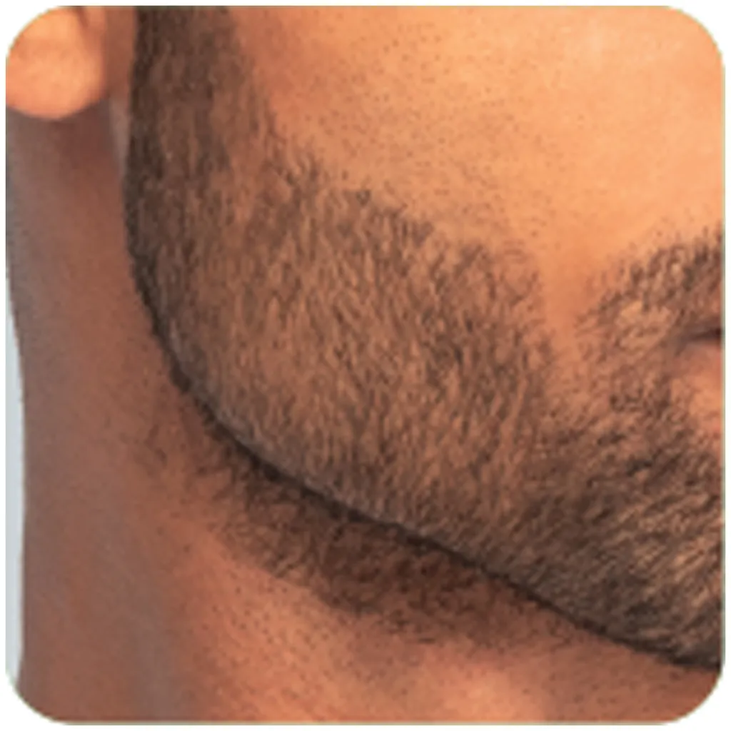 Remington T-Series Ultimate Precision Tondeuse à barbe MB7000